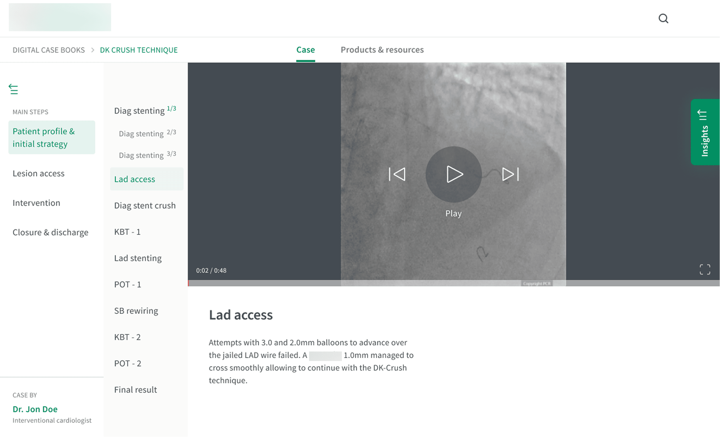 Version A, with sequential step-by-step navigation