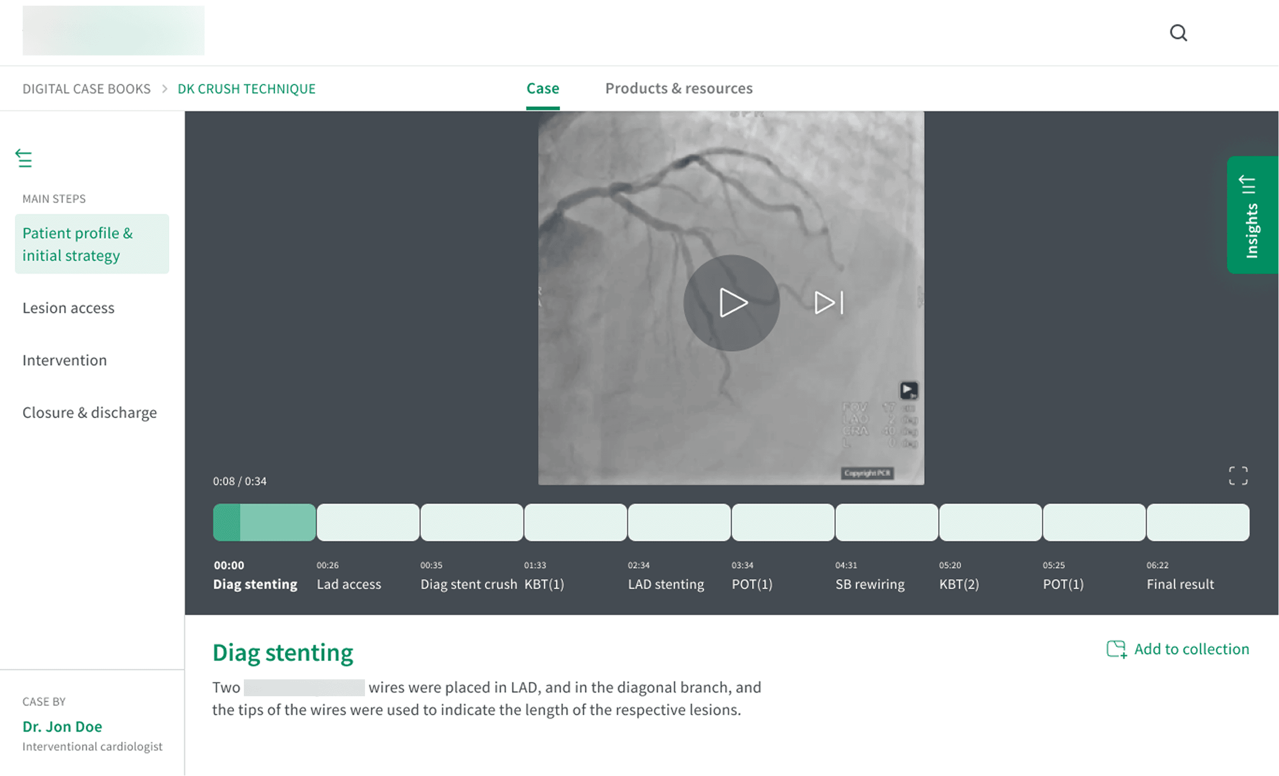 Version B, with a persistent step timeline